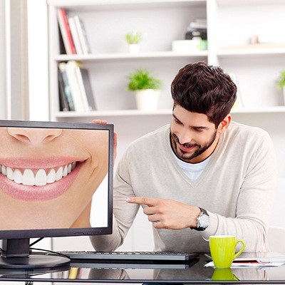 Digital smile design on computer